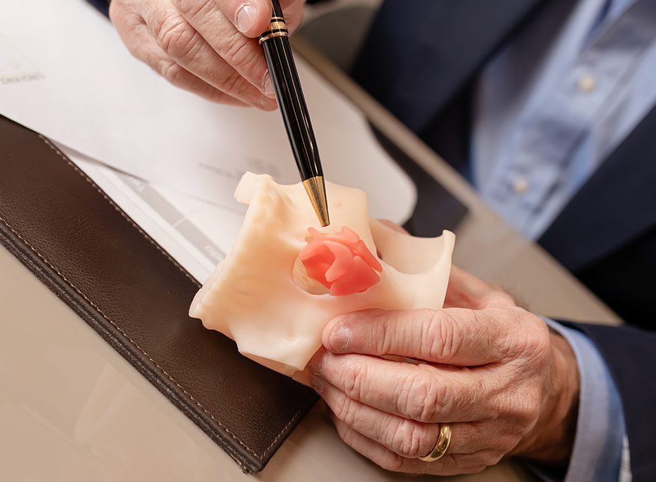 Rinoplastia Funcional